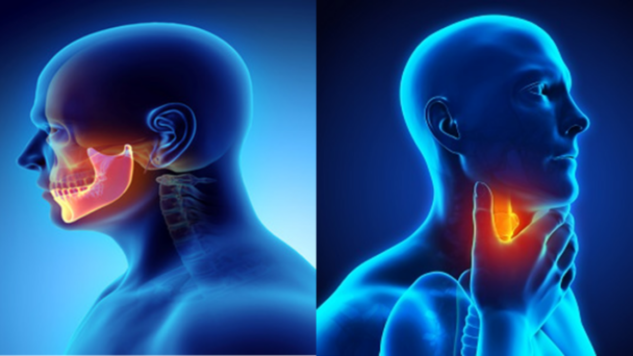 Head & Neck Cancers
