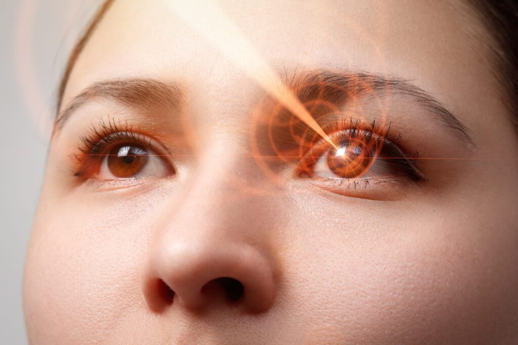 Laser vision correction